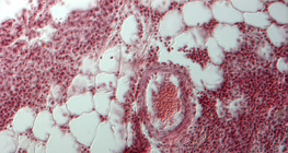 Разрез на бял дроб (човек)