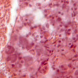 Разрез на хипофиза