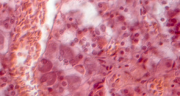 Разрез на хипофиза