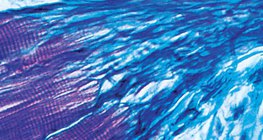 Връзка между мускулите и сухожилията