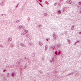 Разрез на хипофиза