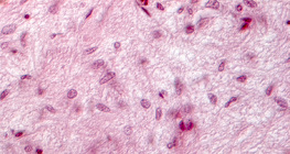 Разрез на хипофиза