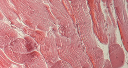 Тъкан на сухожилие (напречен разрез)