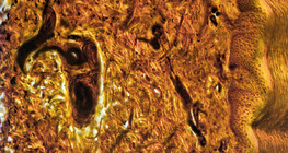 Напречен разрез на кожата на човешки пръст