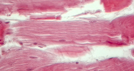 Тъкан на сухожилие (надлъжен разрез)