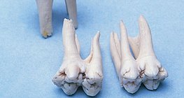 Зъби на всеядно животно