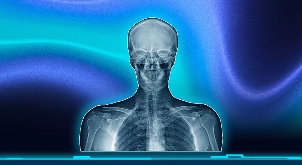 X-rays