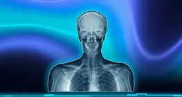 X-rays