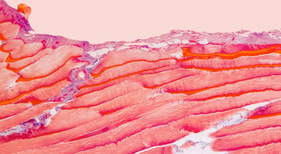 От какви тъкани са изградени мускулите ни?