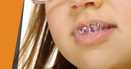 „Разяждащата“ слюнка